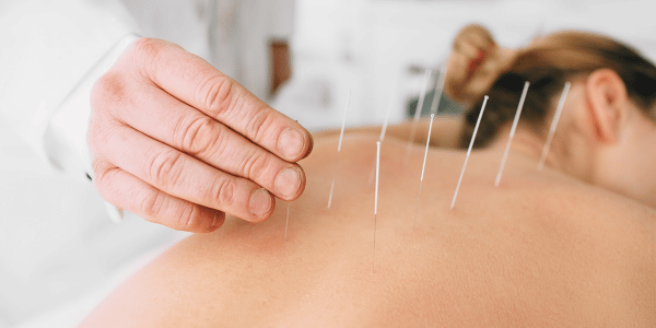paciente-primer-plano-procedimiento-acupuntura (1)