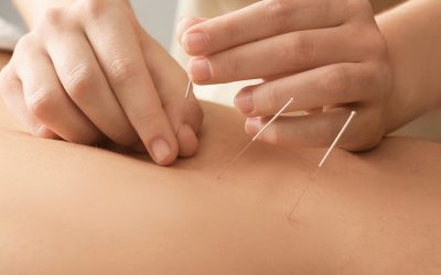 TOP 10 REASONS PEOPLE COME IN FOR ACUPUNCTURE