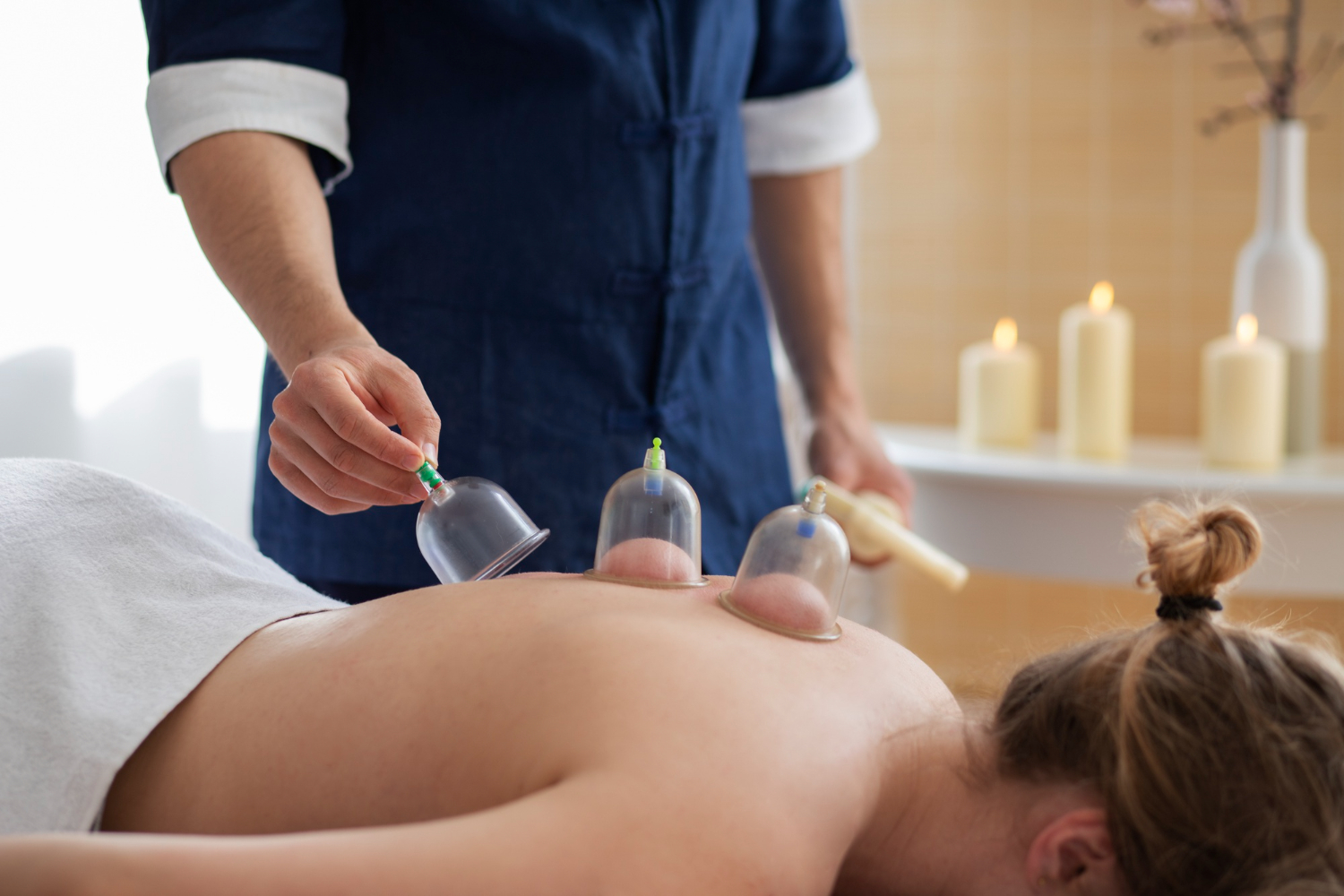 cupping