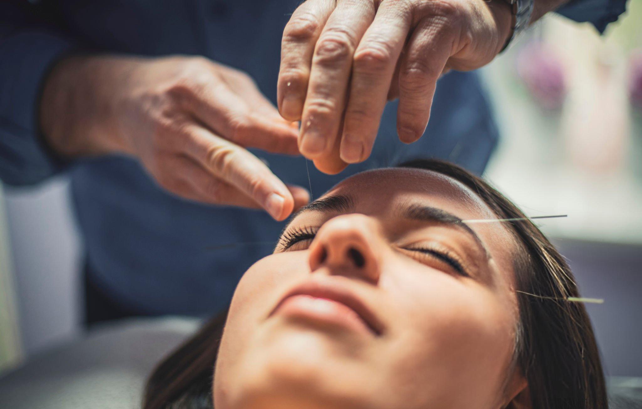 acupuncture for chronic pain