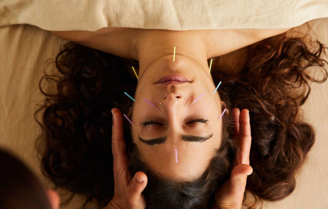 facial rejuvenation with acupuncture