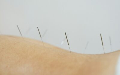 Supporting Natural Fertility with Traditional Acupuncture Approaches