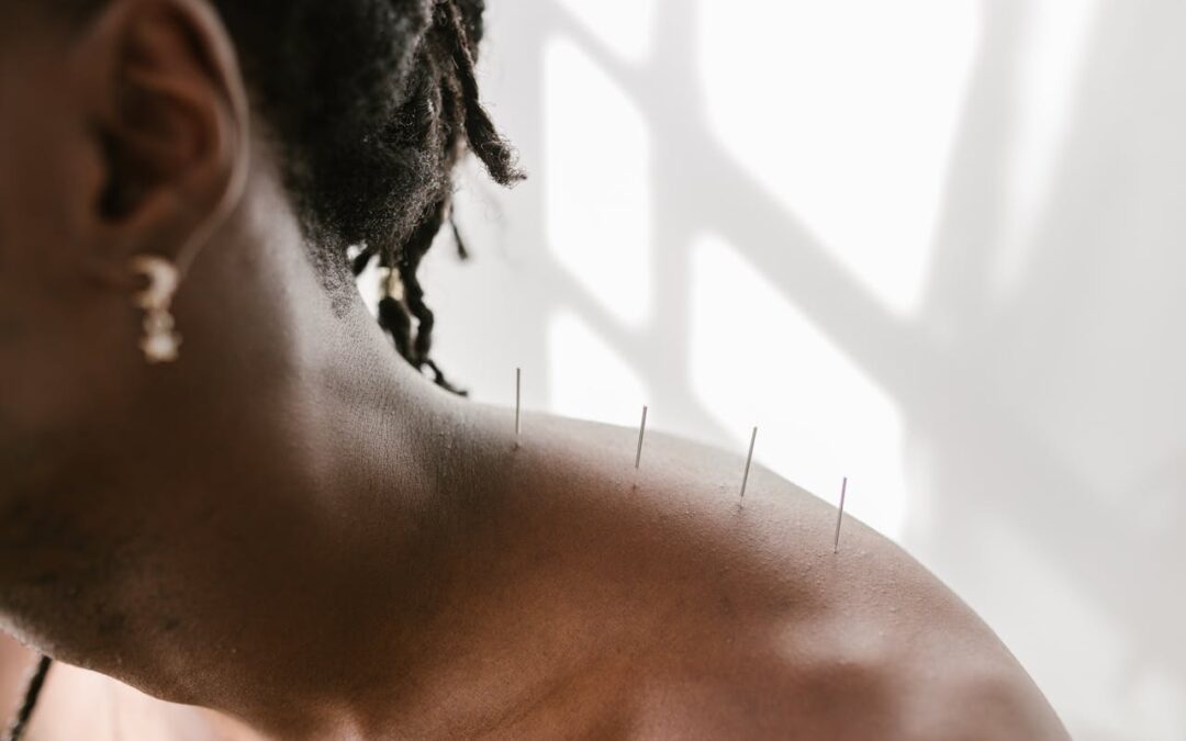 How Acupuncture Can Help with Neck Pain