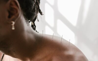 How Acupuncture Can Help with Neck Pain