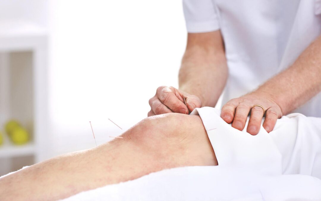Understanding How Acupuncture Supports Knee Pain