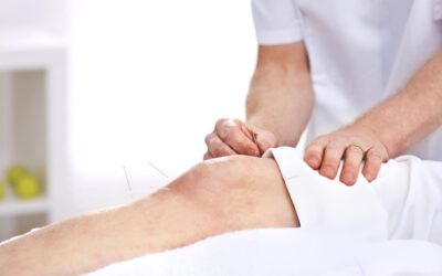 Understanding How Acupuncture Supports Knee Pain