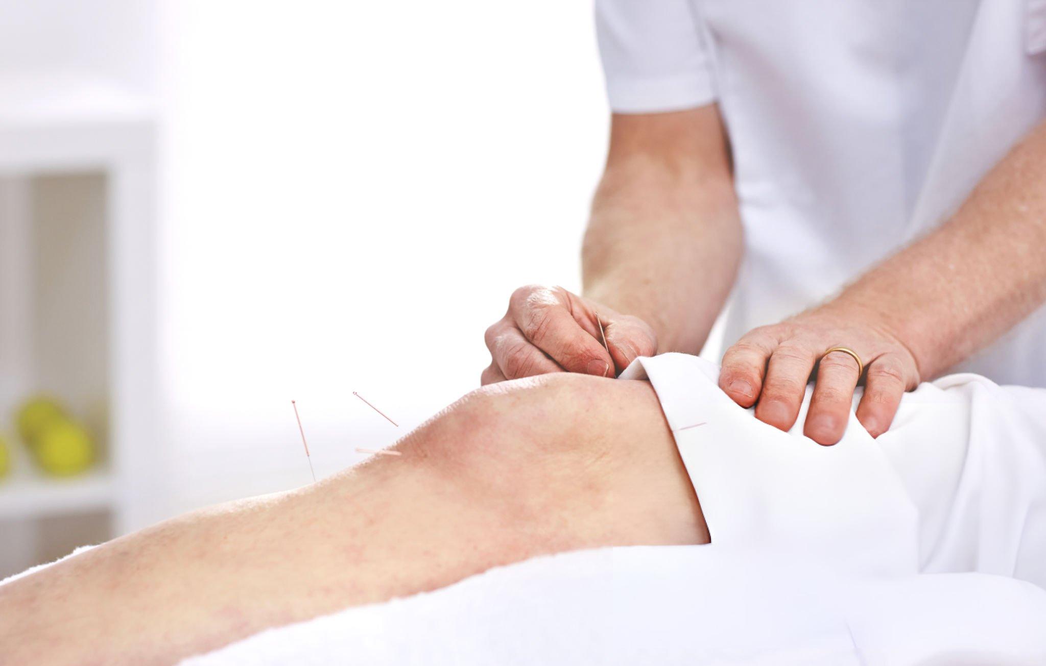 acupuncture for knee pain