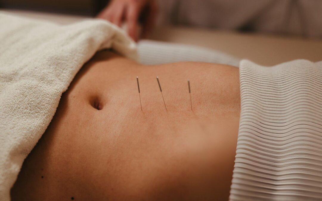 Restoring Balance: Acupuncture for Menstrual Cycle Regulation