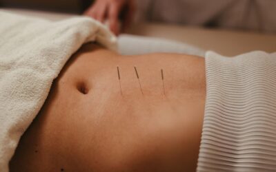 Restoring Balance: Acupuncture for Menstrual Cycle Regulation