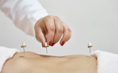 Addressing Digestive Discomfort with Targeted Acupuncture Points