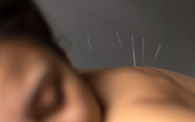 Acupuncture of Support Back Pain Relief This Fall