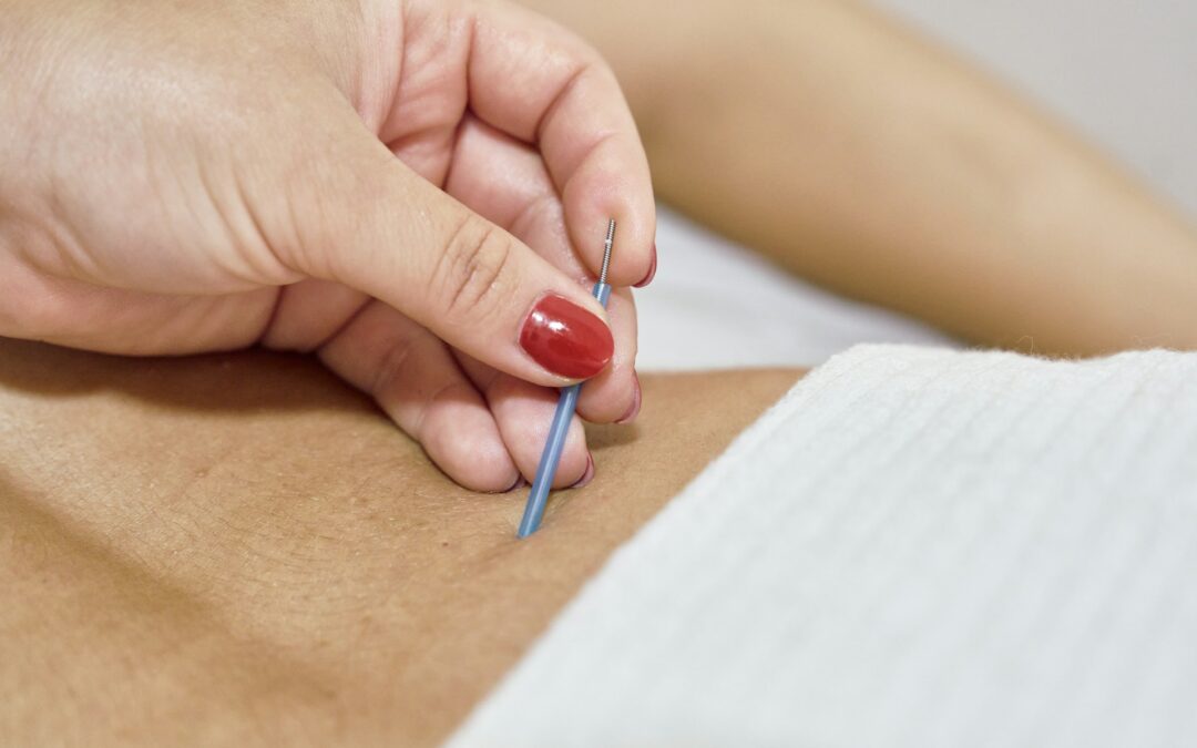 Gentle Approaches to Managing Back Tension and Pain with Acupuncture