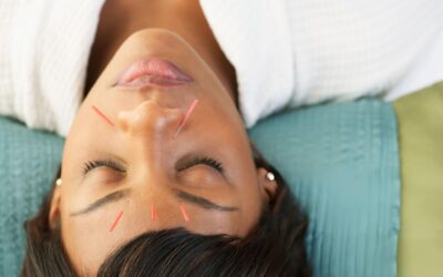 Revitalize Your Skin This Winter with Facial Rejuvenation Acupuncture