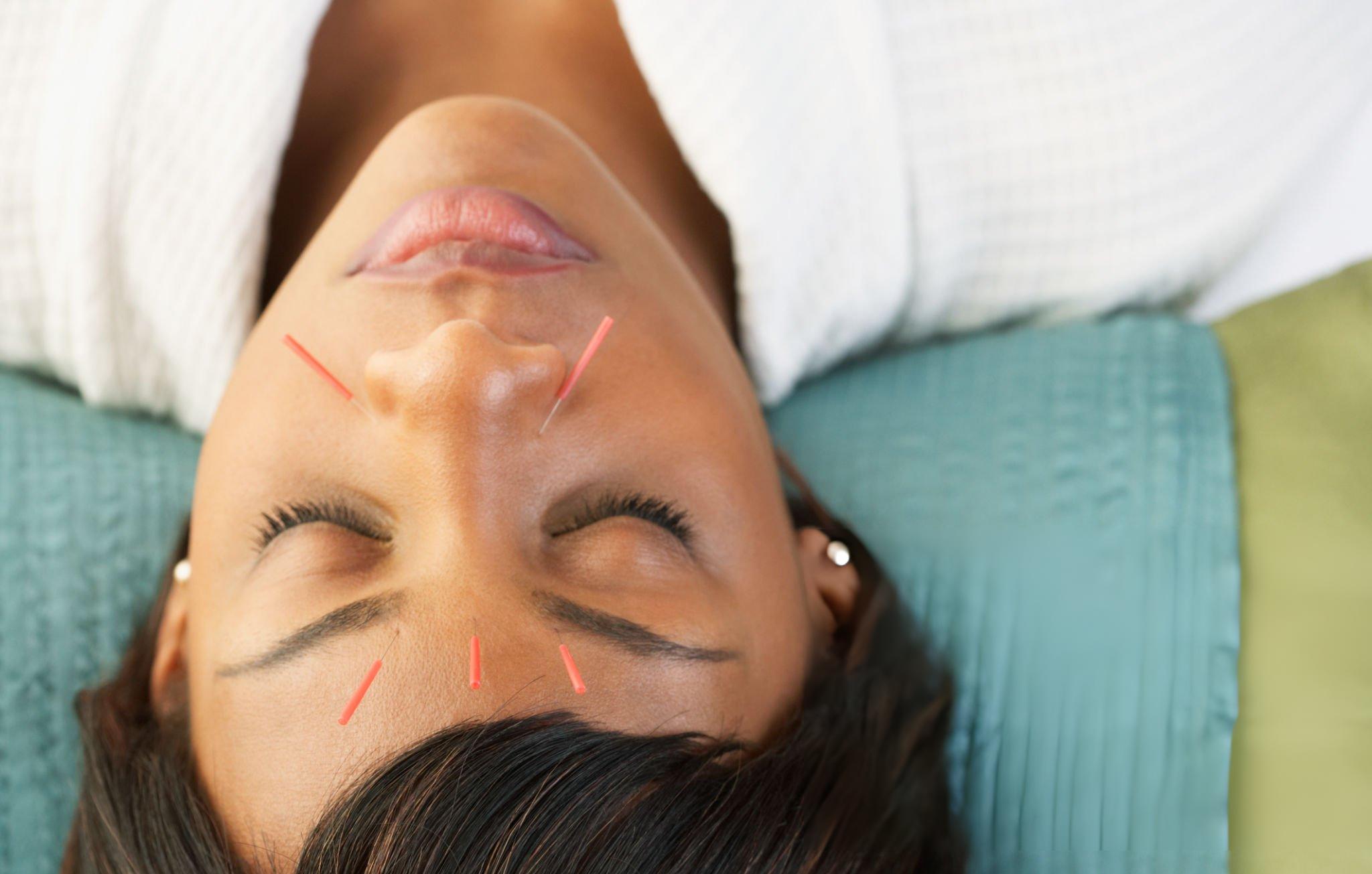 facial rejuvenation with acupuncture facial rejuvenation with acupuncture