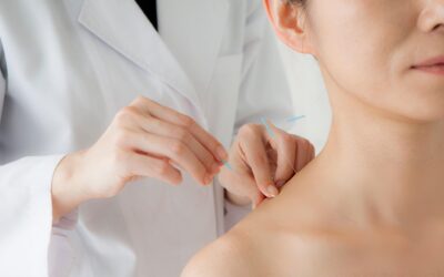 Finding Long Term Comfort with Acupuncture for Shoulder Pain