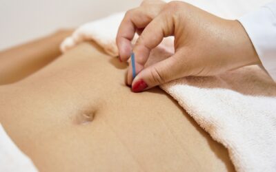 How Acupuncture Services May Support Menstrual Irregularities