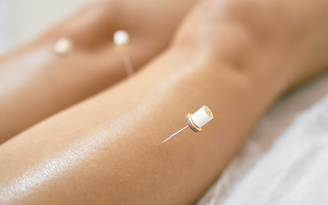 Managing Hip and Knee Pain with Acupuncture During Winter