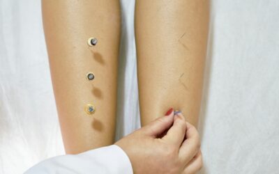 Understanding Acupuncture Solutions for Anxiety Relief in Scottsdale