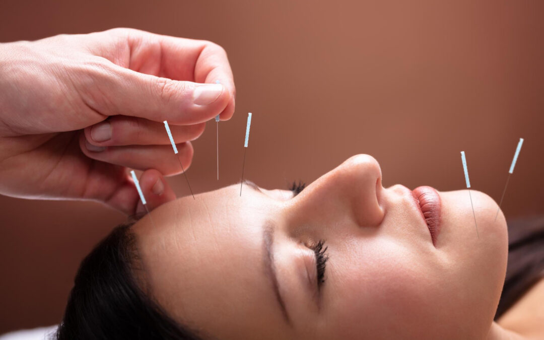 How Acupuncture May Support Gynecological Balance and Reproductive Health