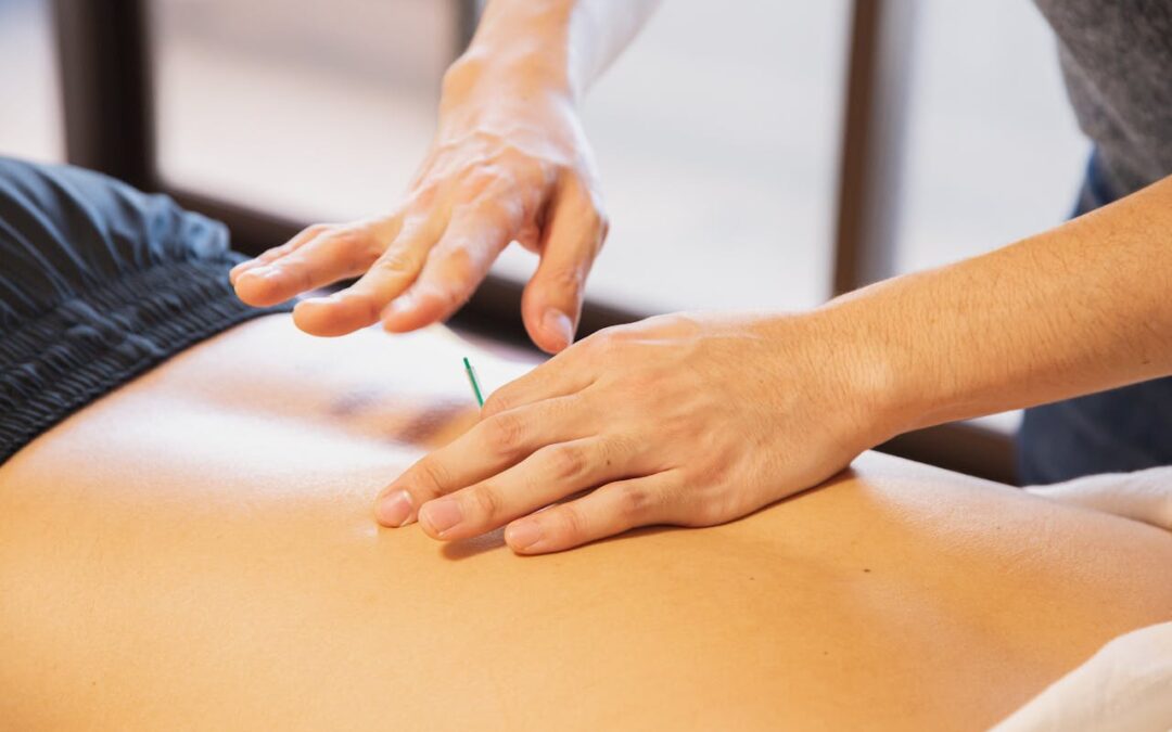 Understanding Acupuncture’s Role in Managing Hip Pain