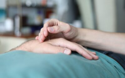 Could Acupuncture Boost Your Immune System This Summer?