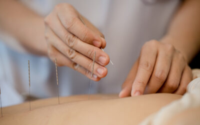 Acupuncture Approaches for Addressing Hip Pain Effectively