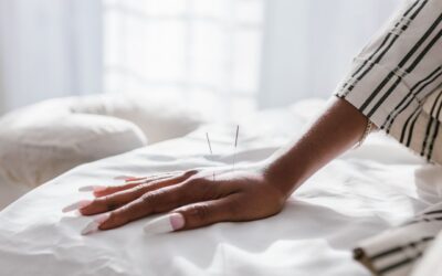 Could Acupuncture Ease My Anxiety Symptoms?