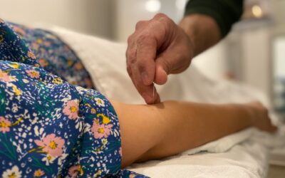 Exploring the Impact of Acupuncture on Reducing Sciatica Symptoms