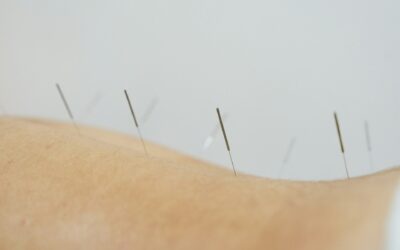 Choosing Between Dry Needling and Acupuncture After Training